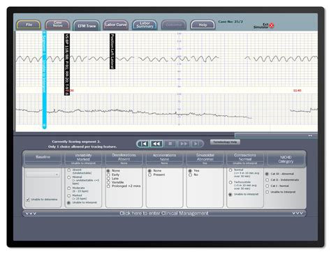 k2 fetal monitoring log in.